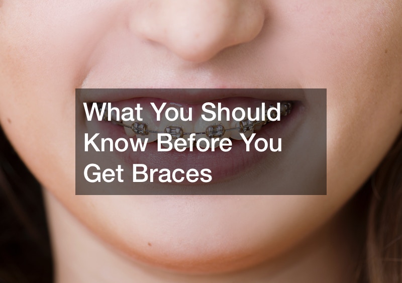 What You Should Know Before You Get Braces
